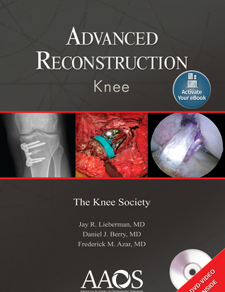 Advanced Reconstruction: Knee: Print + Ebook with Multimedia
