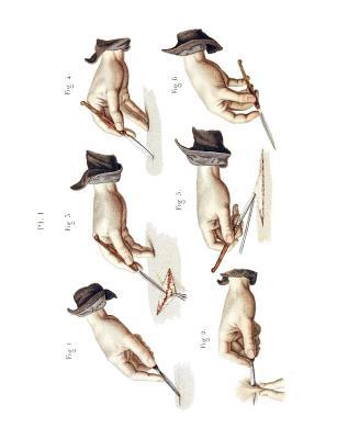 Holding the Bistoury Composition Notebook (Old Medical Illustration Composition Notebooks)