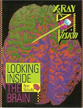 Looking Inside the Brain