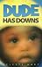 DUDE HAS DOWNS