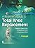 A Beginner's Guide to Total Knee Replacement