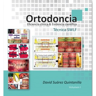 Ortodoncia. Eficiencia clínica y evidencia científica. Técnica SWLF