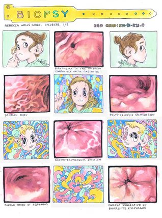 Biopsy