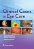 Clinical Cases in Eye Care