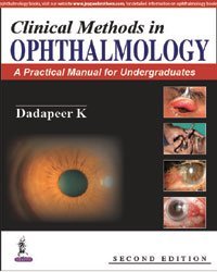 Ophthalmology review book Ophthalmology review book