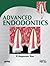 Advanced Endodontics