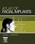 Atlas of Facial Implants