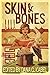 Skin & Bones