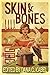 Skin & Bones