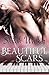 Beautiful Scars