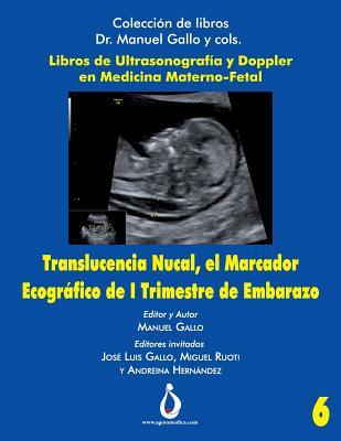 Translucencia Nucal, el marcador ecografico de I trimestre de Embarazo (Colección de Libros Dr. Manuel Gallo y cols)