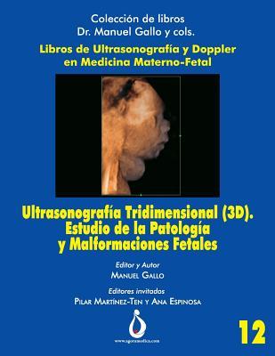Ultrasonografía Tridimensional (3D). Estudio de la Patología y Malformaciones Fetales (Colección de Libros Dr. Manuel Gallo y cols) (Spanish Edition)