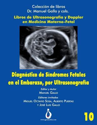 Diagnostico de Síndromes Fetales en el Embarazo, por Ultrasonografia (Colección de Libros Dr. Manuel Gallo y cols)