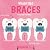 Wearing Braces by Harriet Brundle