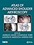 Atlas of Advanced Shoulder Arthroscopy