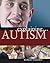 Explaining Autism