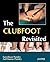 The Club Foot Revisited