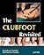 The Club Foot Revisited by Sureshwar Pandey