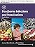 Foodborne Infections and Intoxications by Caroline Smith DeWaal