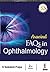 Aravind FAQs in Ophthalmology