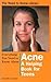 Everything You Need to Know about Acne by Jennifer Ceaser