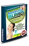 Banish My Bumps