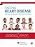 Facing Heart Disease: A Gui...