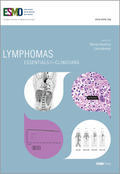 Lymphomas: Essentials for Clinicians
