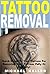 Tattoo Removal: Quick Guide...