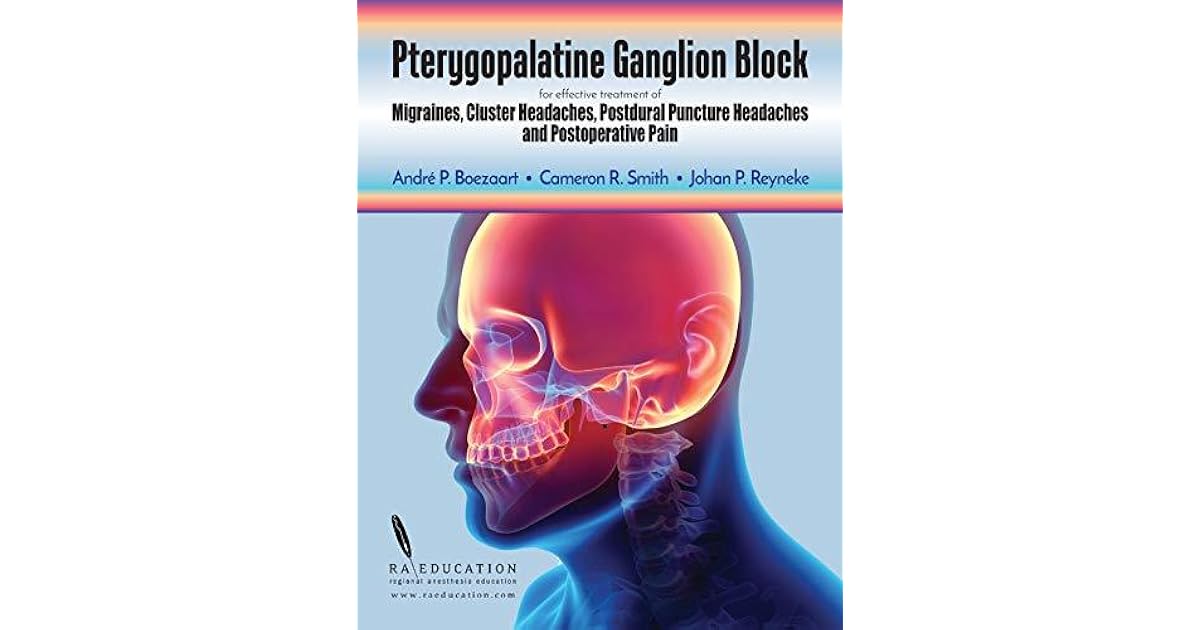 Pterygopalatine Ganglion Block for effective treatment of Migraine, Cluster Headache, Postdural