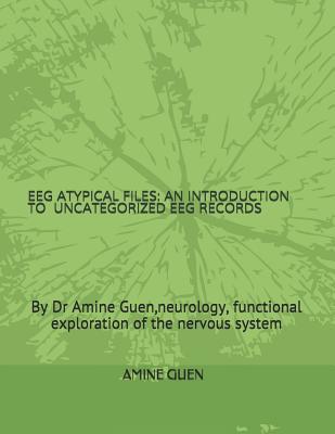 EEG Atypical Files: An Introduction to Uncategorized EEG Records