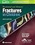 Rockwood and Wilkins Fractures in Children by Peter M. Waters