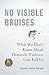 No Visible Bruises: What We...