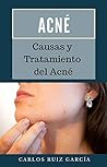 Acné: Causas y Tr...
