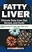 FATTY LIVER DIET: Ultimate Fatty Liver Diet Recipes And Guide 105 Recipes To Help Fight Fatty Liver Disease (Fatty Liver Cure, Fatty Liver Reverse, Fatty Liver Healing, Fatty Liver Diet)