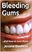 Bleeding Gums