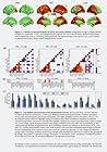 Increased spontaneous MEG signal diversity for psychoactive d... by Michael M. Schartner