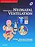 Essentials of Neonatal Vent...