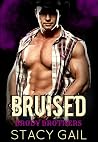 Bruised by Stacy Gail