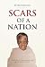 Scars of a Nation: Survivor...