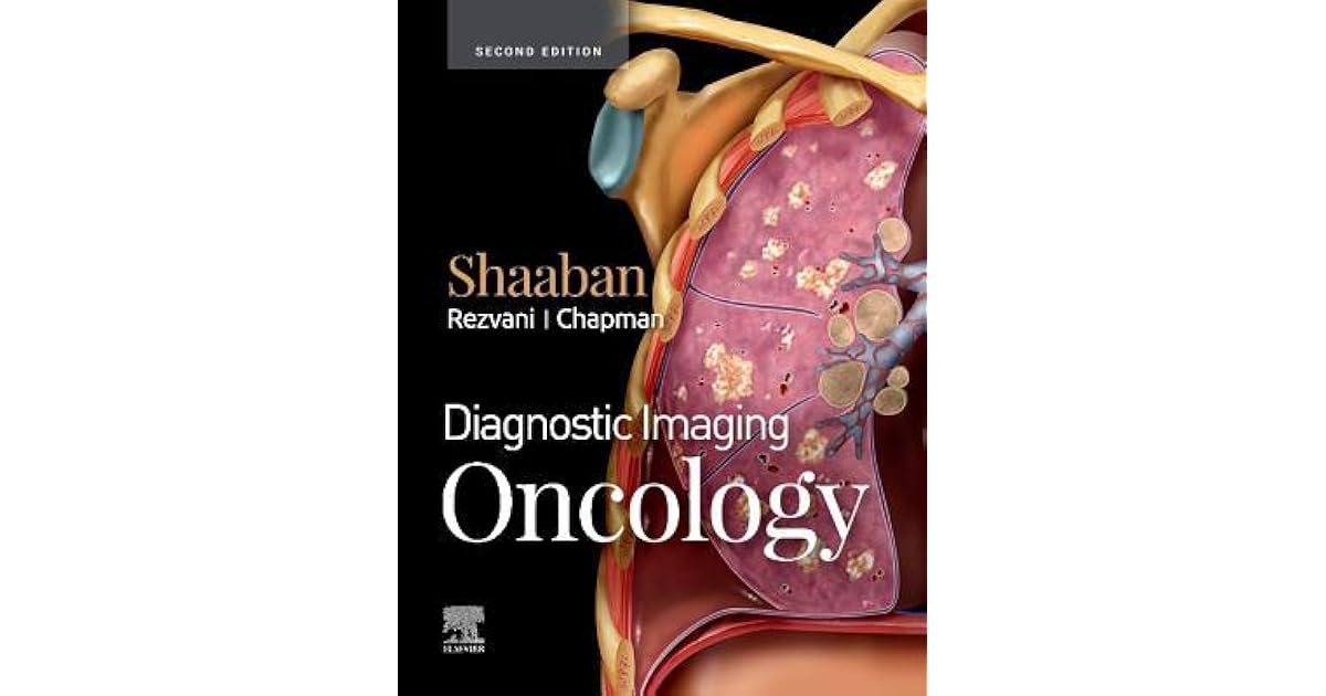 Diagnostic Imaging Oncology by Akram M. Shaaban