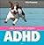 Alle honden hebben ADHD