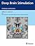 Deep Brain Stimulation: Techniques and Practices