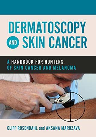 Dermatoscopy and Skin Cancer: A handbook for hunters of skin cancer and melanoma (Kindle Edition)