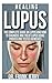 Healing Lupus: The Complete...