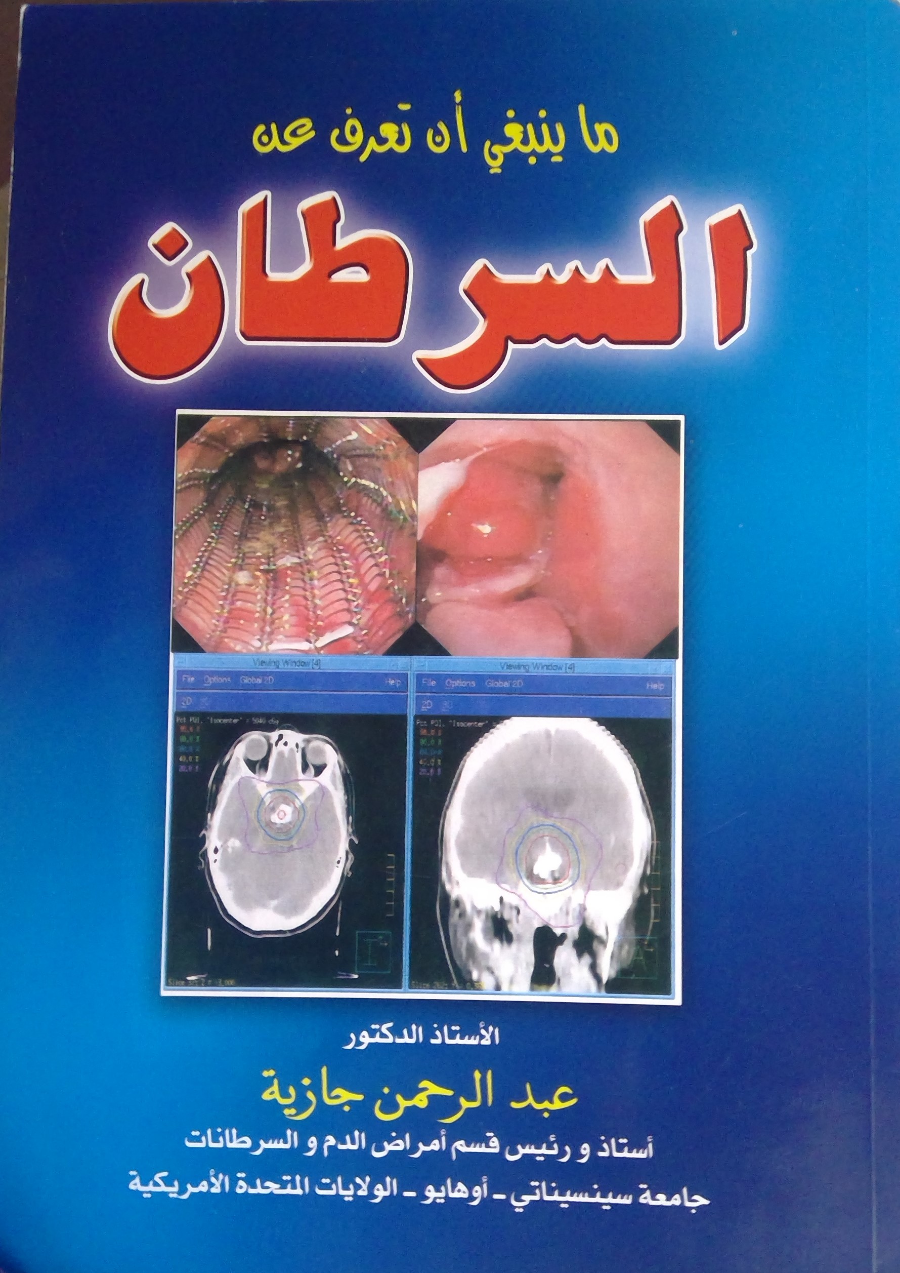 ما ينبغي ان تعرف عن السرطان (Paperback)