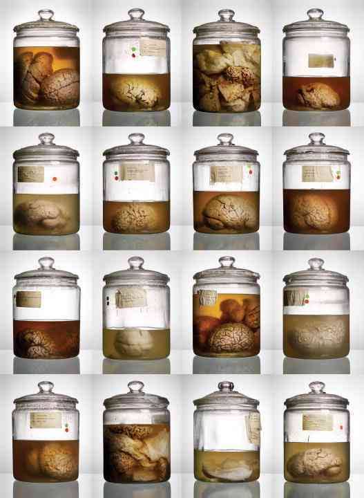 Malformed: Forgotten Brains of the Texas State Mental Hospital (Hardcover)