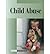 Child Abuse: Current Controversies
