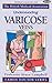 Understanding Varicose Vein...