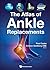 The Atlas of Ankle Replacem...